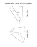 BARIATRIC CLAMP WITH SUTURE PORTIONS, MAGNETIC INSERTS AND CURVATURE diagram and image