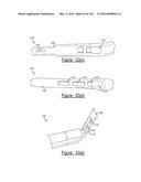 BARIATRIC CLAMP WITH SUTURE PORTIONS, MAGNETIC INSERTS AND CURVATURE diagram and image