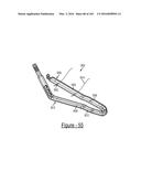 BARIATRIC CLAMP WITH SUTURE PORTIONS, MAGNETIC INSERTS AND CURVATURE diagram and image