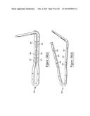 BARIATRIC CLAMP WITH SUTURE PORTIONS, MAGNETIC INSERTS AND CURVATURE diagram and image