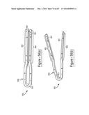 BARIATRIC CLAMP WITH SUTURE PORTIONS, MAGNETIC INSERTS AND CURVATURE diagram and image