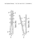 BARIATRIC CLAMP WITH SUTURE PORTIONS, MAGNETIC INSERTS AND CURVATURE diagram and image