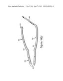 BARIATRIC CLAMP WITH SUTURE PORTIONS, MAGNETIC INSERTS AND CURVATURE diagram and image