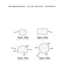 BARIATRIC CLAMP WITH SUTURE PORTIONS, MAGNETIC INSERTS AND CURVATURE diagram and image