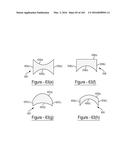 BARIATRIC CLAMP WITH SUTURE PORTIONS, MAGNETIC INSERTS AND CURVATURE diagram and image