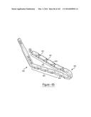 BARIATRIC CLAMP WITH SUTURE PORTIONS, MAGNETIC INSERTS AND CURVATURE diagram and image