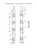 BARIATRIC CLAMP WITH SUTURE PORTIONS, MAGNETIC INSERTS AND CURVATURE diagram and image