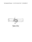 BARIATRIC CLAMP WITH SUTURE PORTIONS, MAGNETIC INSERTS AND CURVATURE diagram and image