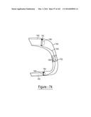 BARIATRIC CLAMP WITH SUTURE PORTIONS, MAGNETIC INSERTS AND CURVATURE diagram and image