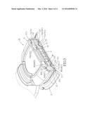 JOINT ORTHOSIS diagram and image