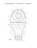 Ostomy Applicance diagram and image