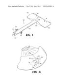 DEVICE AND METHOD FOR REDUCING INTRAOCULAR PRESSURE diagram and image