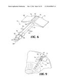 DEVICE AND METHOD FOR REDUCING INTRAOCULAR PRESSURE diagram and image