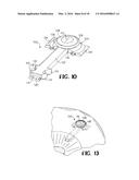 DEVICE AND METHOD FOR REDUCING INTRAOCULAR PRESSURE diagram and image