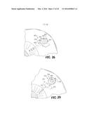 DEVICE AND METHOD FOR REDUCING INTRAOCULAR PRESSURE diagram and image