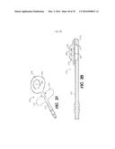 DEVICE AND METHOD FOR REDUCING INTRAOCULAR PRESSURE diagram and image