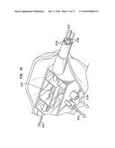 External Ear Canal Pressure Regulation System diagram and image