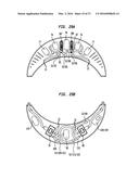 External Ear Canal Pressure Regulation System diagram and image