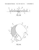 APPARATUSES AND METHODS FOR MINIMIZING WOUND DEHISCENCE, SCAR SPREAD,     AND/OR THE LIKE diagram and image