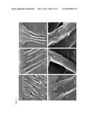 NANOSTRUCTURED ANTIBACTERIAL AND REMINERALIZING DENTAL BONDING AGENTS AND     DENTAL BONDING SYSTEMS diagram and image