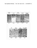 SEX STEROID PRECURSORS ALONE OR IN COMBINATION WITH SELECTIVE ESTROGEN     RECEPTOR MODULATORS FOR THE PREVENTION AND TREATMENT OF DYSPAREUNIA IN     POSTMENOPAUSAL WOMEN diagram and image