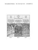 SEX STEROID PRECURSORS ALONE OR IN COMBINATION WITH SELECTIVE ESTROGEN     RECEPTOR MODULATORS FOR THE PREVENTION AND TREATMENT OF DYSPAREUNIA IN     POSTMENOPAUSAL WOMEN diagram and image