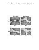 SEX STEROID PRECURSORS ALONE OR IN COMBINATION WITH SELECTIVE ESTROGEN     RECEPTOR MODULATORS FOR THE PREVENTION AND TREATMENT OF DYSPAREUNIA IN     POSTMENOPAUSAL WOMEN diagram and image