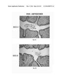 SEX STEROID PRECURSORS ALONE OR IN COMBINATION WITH SELECTIVE ESTROGEN     RECEPTOR MODULATORS FOR THE PREVENTION AND TREATMENT OF DYSPAREUNIA IN     POSTMENOPAUSAL WOMEN diagram and image