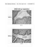 SEX STEROID PRECURSORS ALONE OR IN COMBINATION WITH SELECTIVE ESTROGEN     RECEPTOR MODULATORS FOR THE PREVENTION AND TREATMENT OF DYSPAREUNIA IN     POSTMENOPAUSAL WOMEN diagram and image