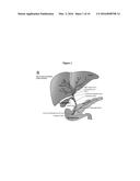 METHOD OF TREATING PANCREATIC AND LIVER CONDITIONS BY ENDOSCOPIC-MEDIATED     (OR LAPAROSCOPIC-MEDIATED) TRANSPLANTATION OF STEM CELLS INTO/ONTO BILE     DUCT WALLS OF PARTICULAR REGIONS OF THE BILIARY TREE diagram and image