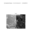 METHOD OF TREATING PANCREATIC AND LIVER CONDITIONS BY ENDOSCOPIC-MEDIATED     (OR LAPAROSCOPIC-MEDIATED) TRANSPLANTATION OF STEM CELLS INTO/ONTO BILE     DUCT WALLS OF PARTICULAR REGIONS OF THE BILIARY TREE diagram and image