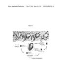 METHOD OF TREATING PANCREATIC AND LIVER CONDITIONS BY ENDOSCOPIC-MEDIATED     (OR LAPAROSCOPIC-MEDIATED) TRANSPLANTATION OF STEM CELLS INTO/ONTO BILE     DUCT WALLS OF PARTICULAR REGIONS OF THE BILIARY TREE diagram and image