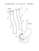 ADJUNCTS FOR GASTROINTESTINAL DEVICES diagram and image