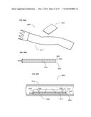 ADJUNCTS FOR GASTROINTESTINAL DEVICES diagram and image