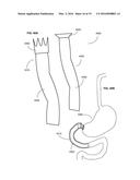 ADJUNCTS FOR GASTROINTESTINAL DEVICES diagram and image