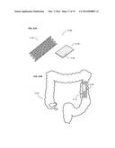 ADJUNCTS FOR GASTROINTESTINAL DEVICES diagram and image