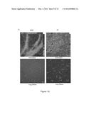 THERAPEUTIC FOR TREATING CLOSTRIDIUM DIFFICILE INFECTION diagram and image