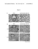 ANTI-TUMOR DNA VACCINE diagram and image