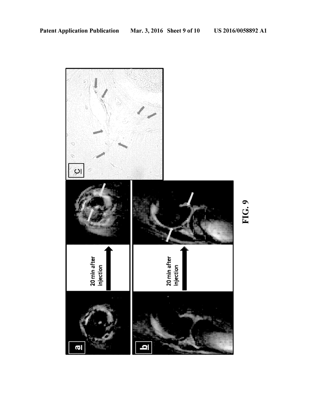 PREPARATION OF BONE-SEEKING SUPERPARAMAGNETIC IRON NANOPARTICLES AS     CONTRAST AGENTS AND METHODS FOR USING THE SAME - diagram, schematic, and image 10