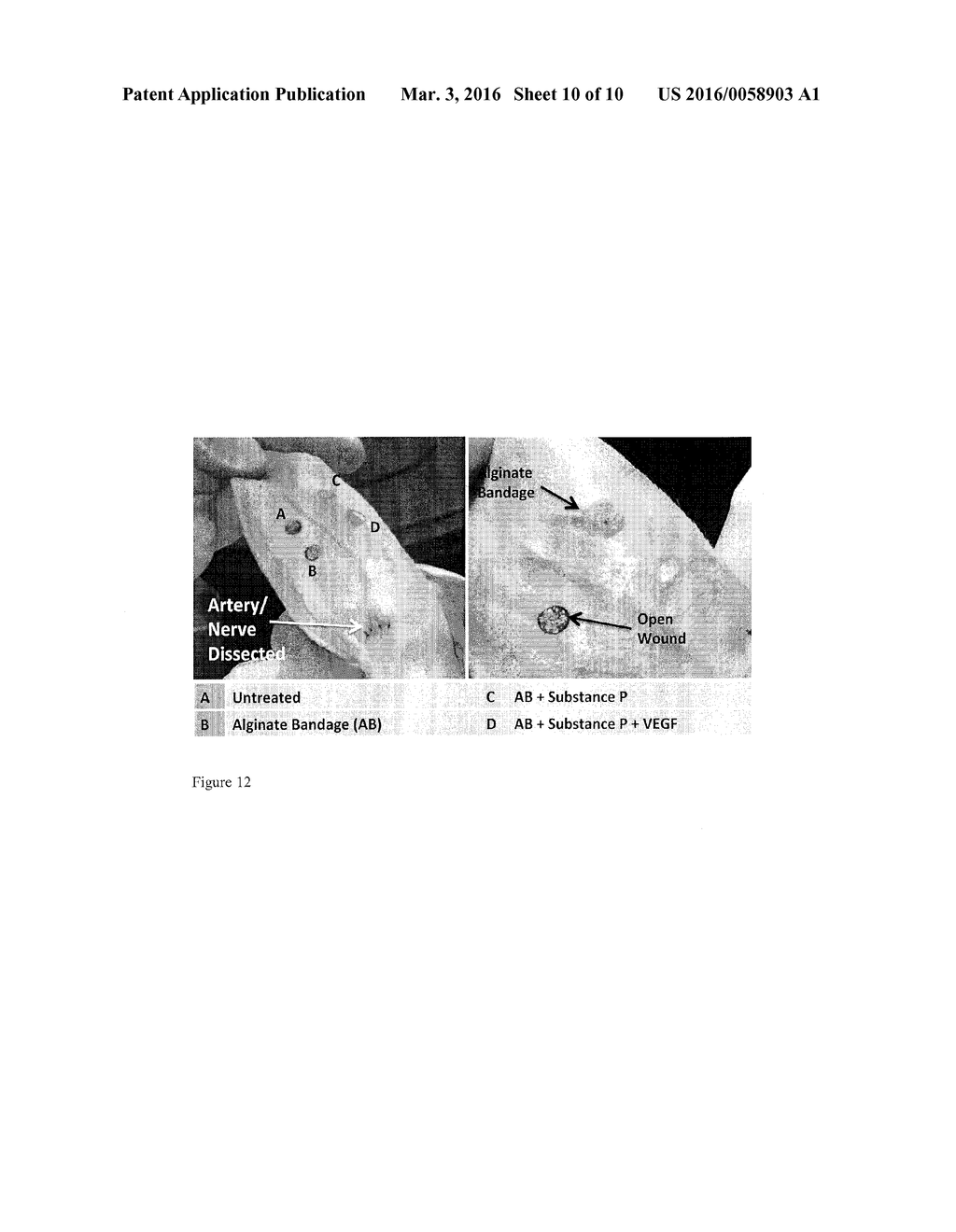 PREFABRICATED ALGINATE-DRUG BANDAGES - diagram, schematic, and image 11