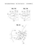 NASAL AEROSOL DELIVERY SYSTEM diagram and image