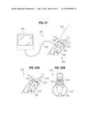 NASAL AEROSOL DELIVERY SYSTEM diagram and image