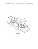 PADDLE LEADS CONFIGURED FOR SUTURE FIXATION diagram and image