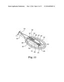 PADDLE LEADS CONFIGURED FOR SUTURE FIXATION diagram and image