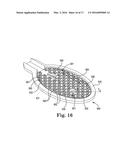 PADDLE LEADS CONFIGURED FOR SUTURE FIXATION diagram and image