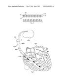 STYRENE-ISOBUTYLENE COPOLYMERS AND MEDICAL DEVICES CONTAINING THE SAME diagram and image