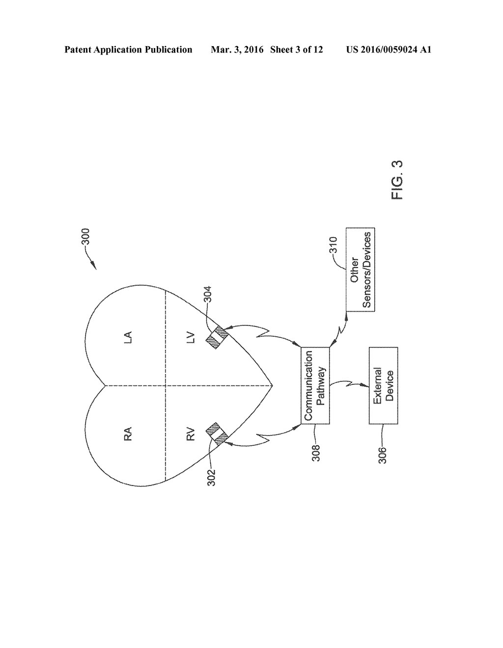 DISPLAY OF TEMPORALLY ALIGNED HEART INFORMATION FROM SEPARATE IMPLANTABLE     MEDICAL DEVICES ON AN EXTRACORPOREAL DISPLAY - diagram, schematic, and image 04