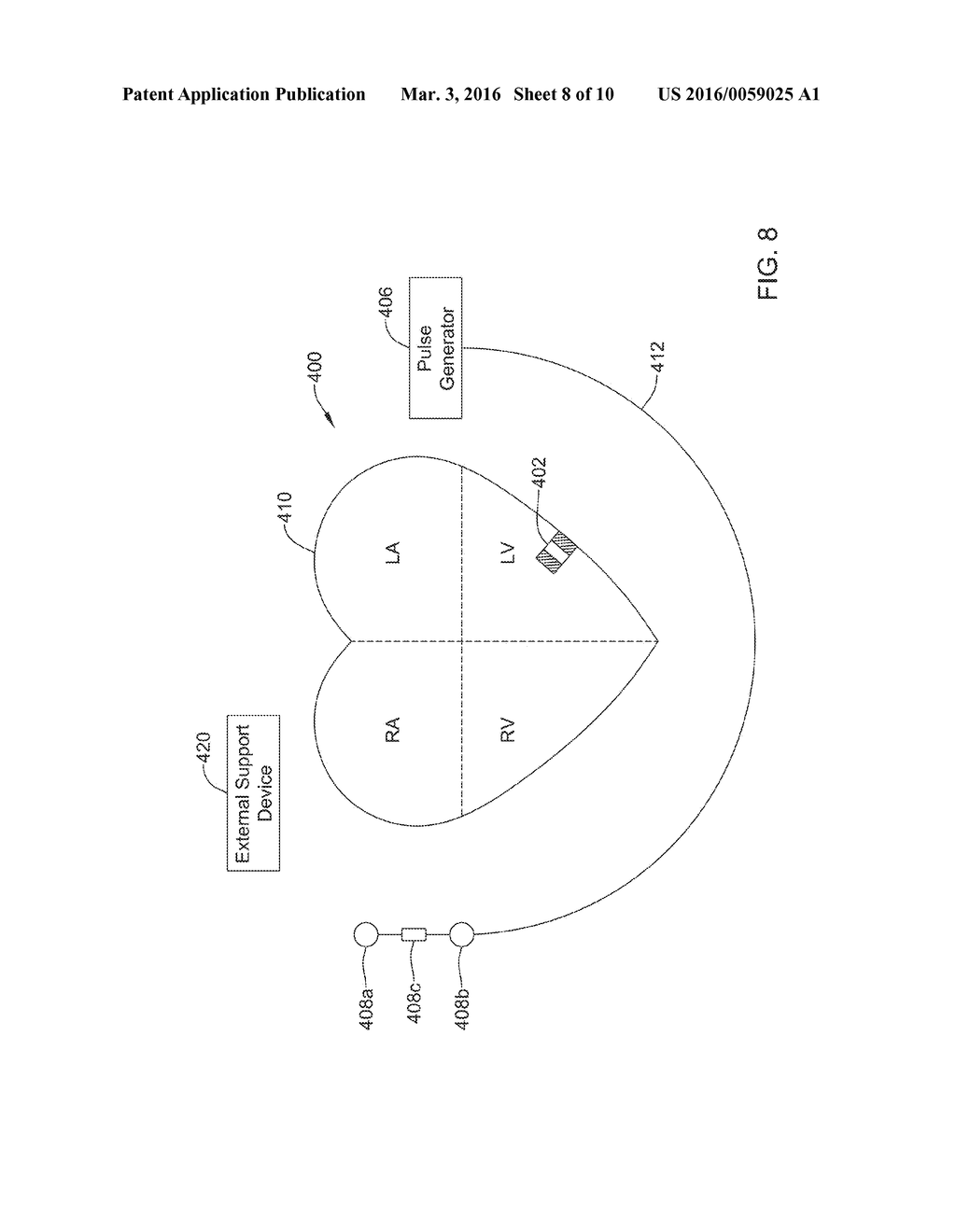 MEDICAL DEVICE WITH TRIGGERED BLANKING PERIOD - diagram, schematic, and image 09