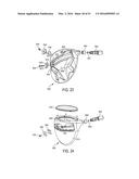 GOLF CLUB HEAD diagram and image