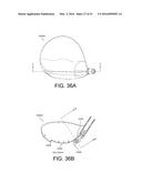 GOLF CLUB HEAD diagram and image